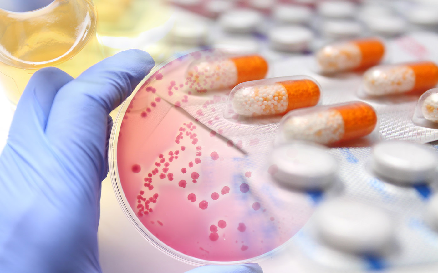 Antibiotic stewardship graphic showing petrie dish with positive growth and oral antibiotic medications.