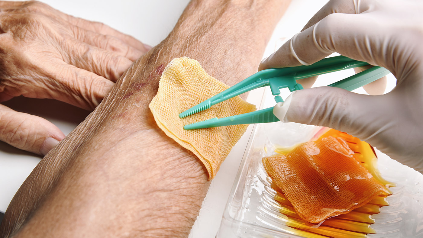 Gloved nurse applying a sterile dressing as part of pressure injury management in a long-term care setting.